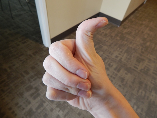 Ngón tay cái bẻ ngược (Hitchhiker’s thumb)